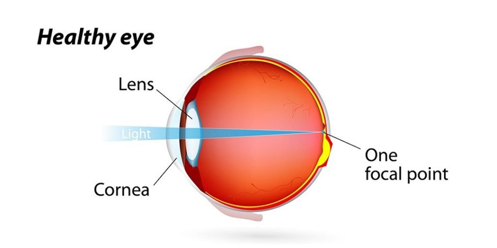 Different Types of Astigmatism